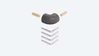 Corner kit for landing banister BOSTON Anthracite, RAL 7016